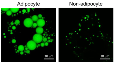 LipiDye II -Diagnocine-09282023